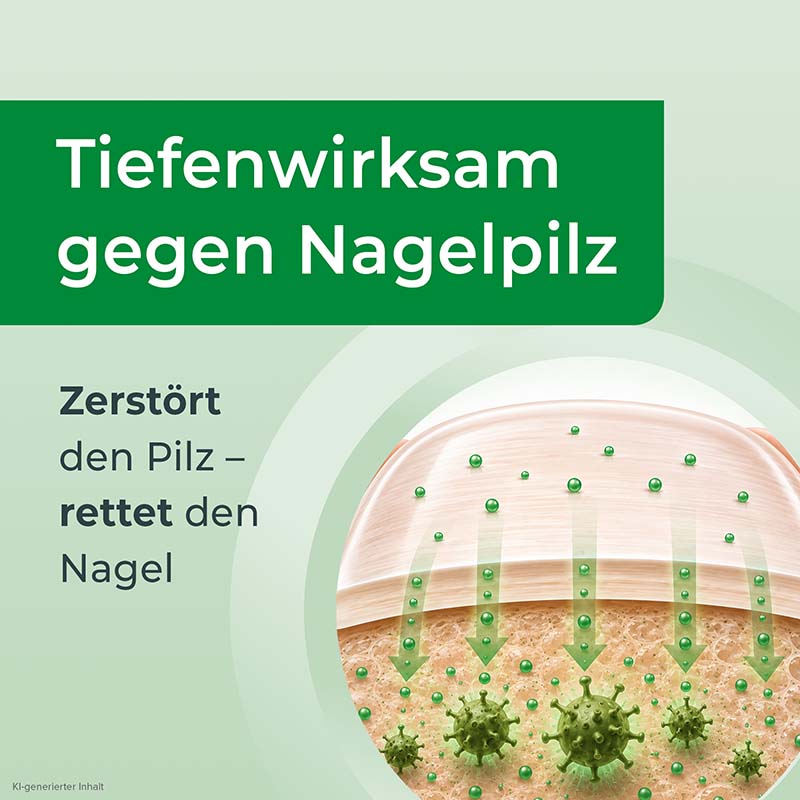 Ciclopoli gegen Nagelpilz Nagellack mit Applikationshilfe 6.6 ml Wirkstoffhaltiger Nagellack