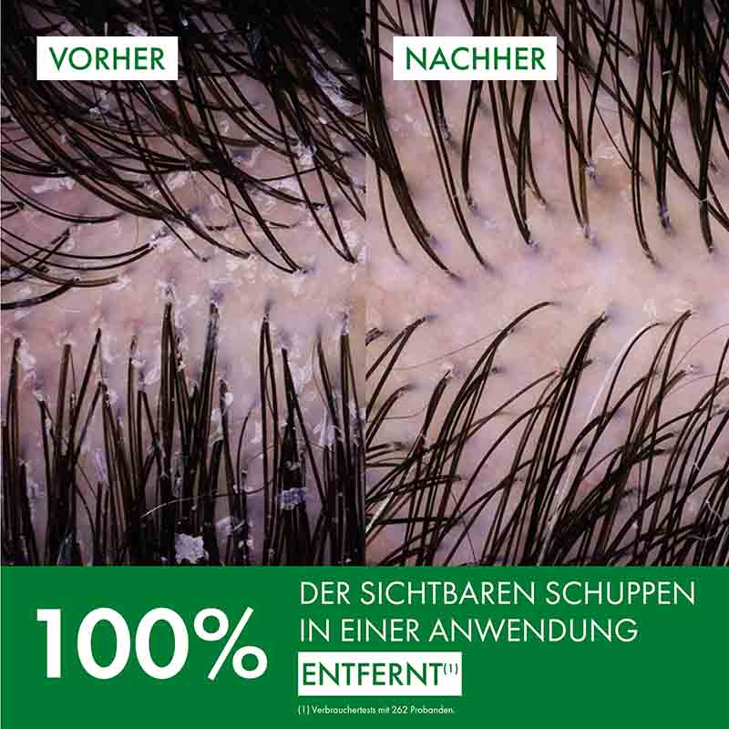 VICHY DERCOS Anti-Schuppen Shampoo trockene Kopfhaut  390 ml Shampoo