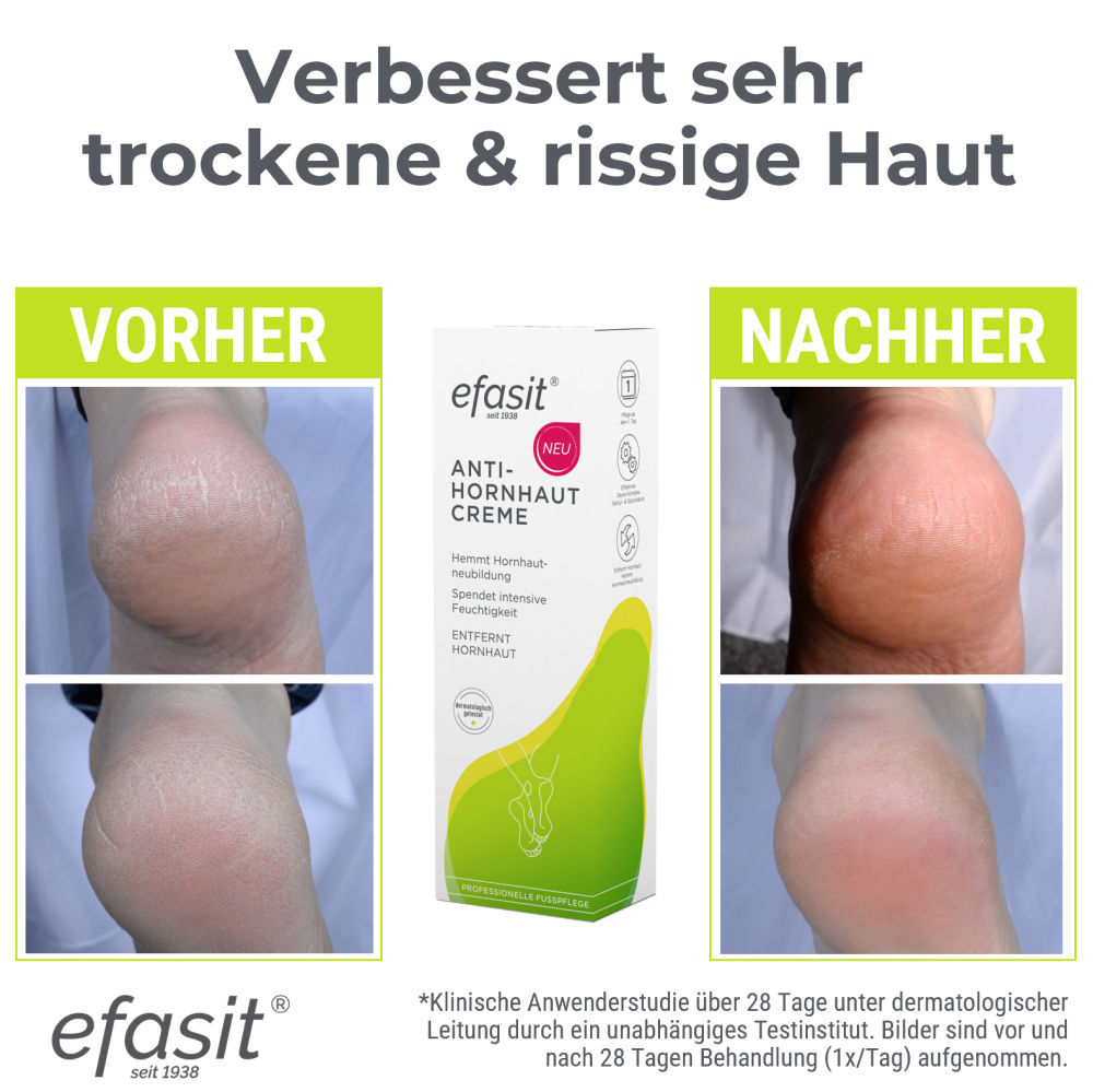 efasit ANTI-HORNHAUT CREME 75 ml Creme