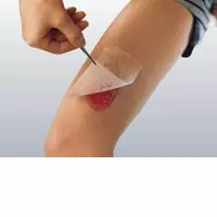 CUTICERIN 20x40 cm Gaze m.Salbenbeschichtung 25 St Kompressen