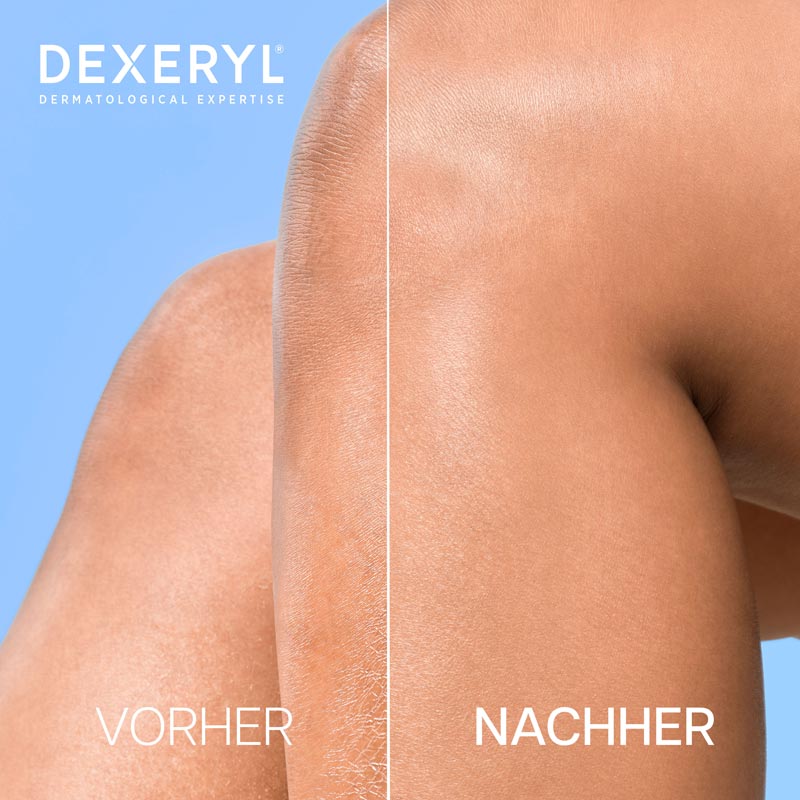 DEXERYL Shower Duschcreme 200 ml Duschgel