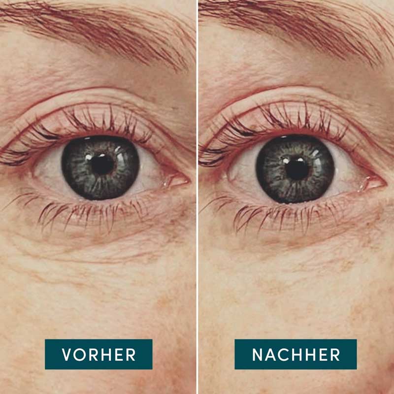 APRICOT Augen Pads mit Hyaluron, wiederverwendbar 2 St
