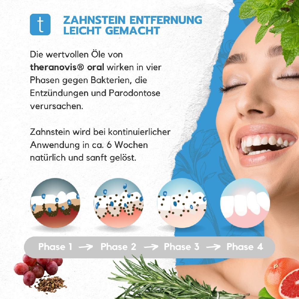 theranovis oral Zahnstein spray 65 ml Spray