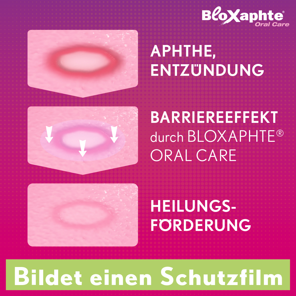 Bloxaphte Oral Care Mundspülung bei Aphthen und Verletzungen im Mund 100 ml Mundwasser